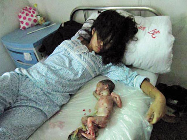 七個半月大的嬰兒死胎被放在母親身邊。